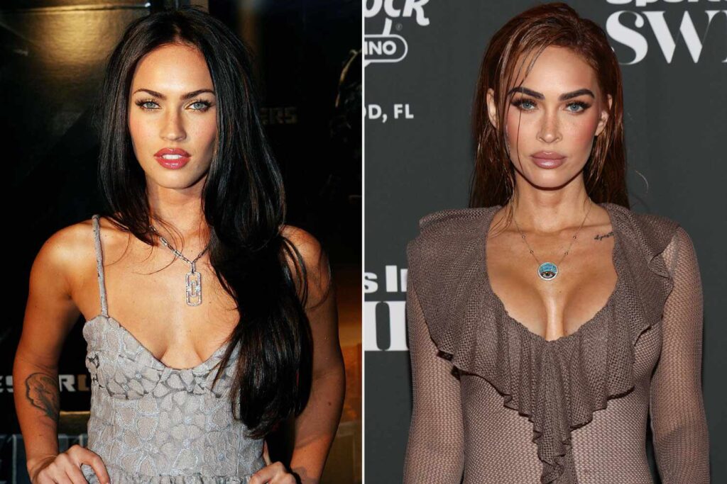 Megan Fox admits she's been using breast implants since she was 21